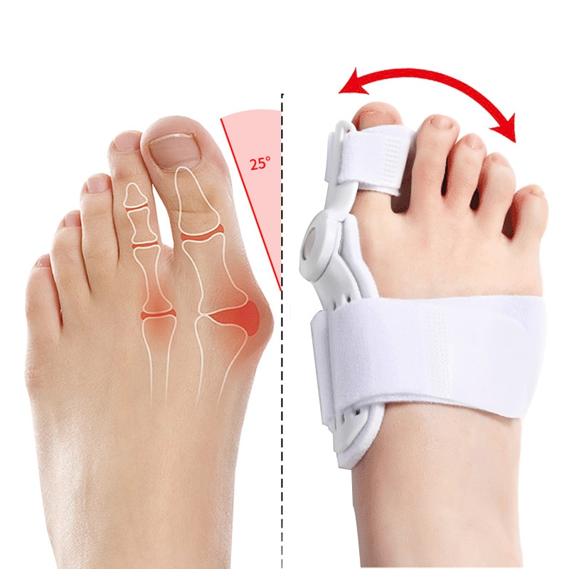 Adjustable Bunion Corrector | Foot & Toe Support